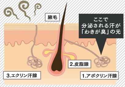 ディーアジカ　ワキガ臭が発生するメカニズム